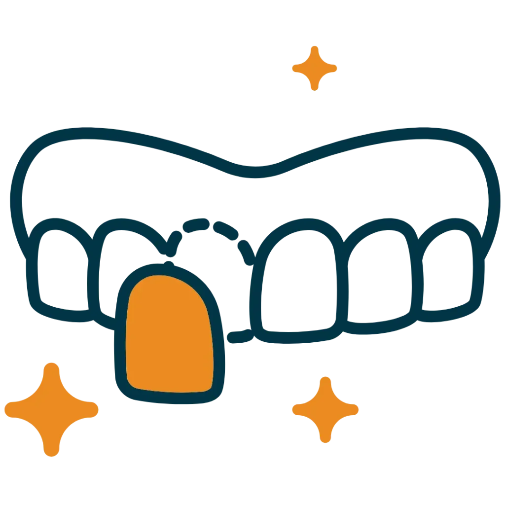 Faccette dentali