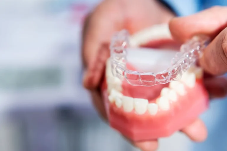 How quickly does the clear aligner work