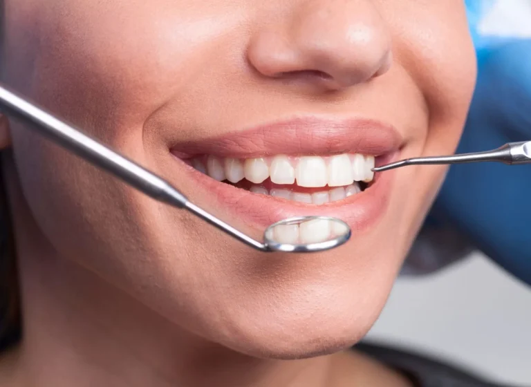 professional teeth cleaning