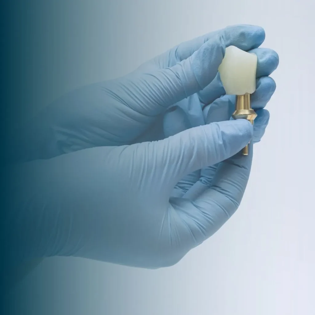 dental implants in Dubai