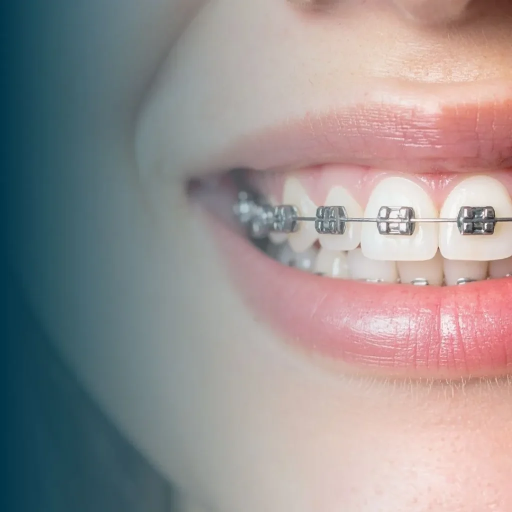 Orthodontist in Dubai