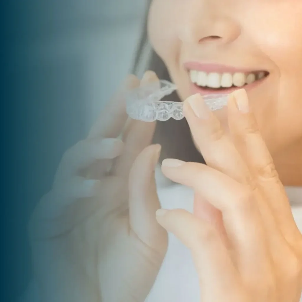 Clear aligners in Dubai